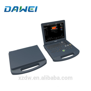 Scanner d&#39;ultrason portatif de prix de machine d&#39;ultrason de Doppler de couleur de Digital complet